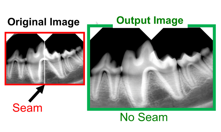 Dental intraoral sensor S15585 - image stitching algorithm