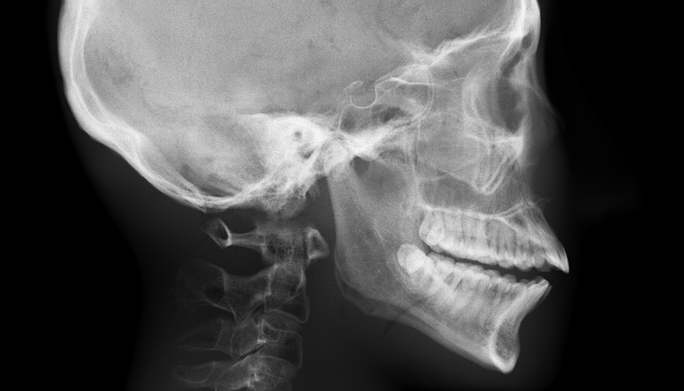 Example of cephalometric X-ray image