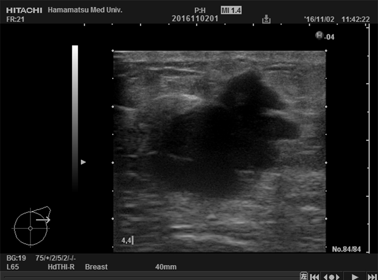 Ultrasonic image (Baseline)