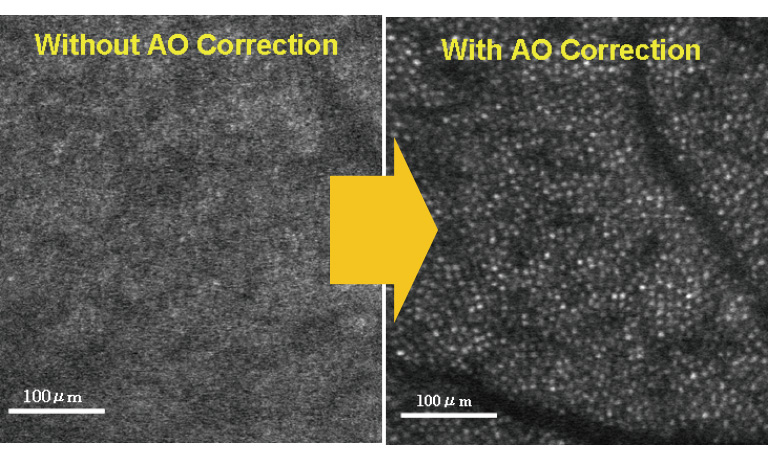 Adaptive optics & ophthalmoscopes