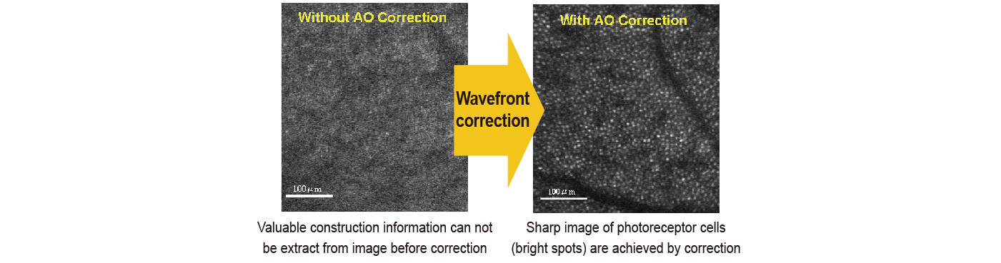 examples of human retina images demonstrating the effect of aberration correction
