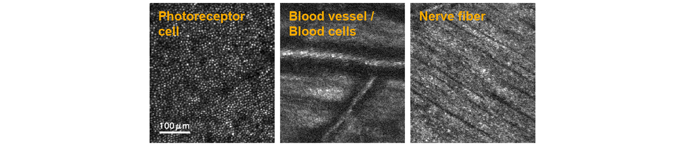 Imaging results when focus on different depth position