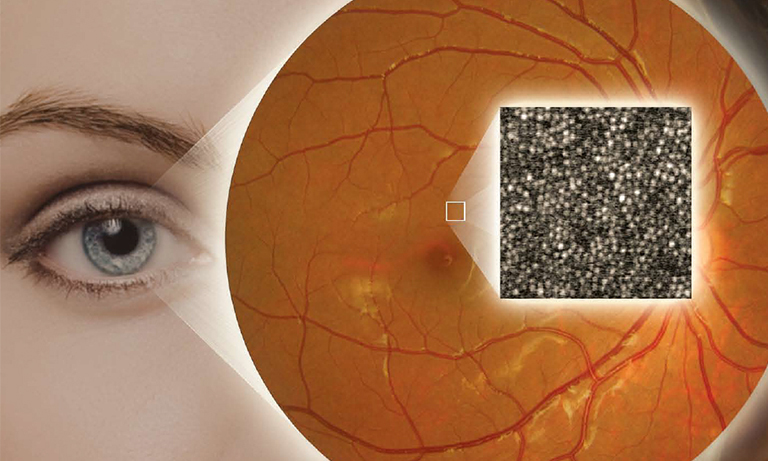 Adaptive optics technology and high-resolution retina imaging