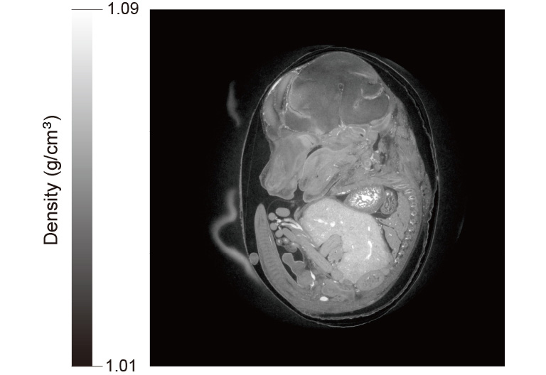 X-ray phase contrast CT image of mouse embryo