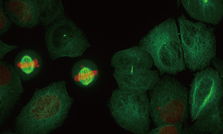 qCMOS Application Examples
