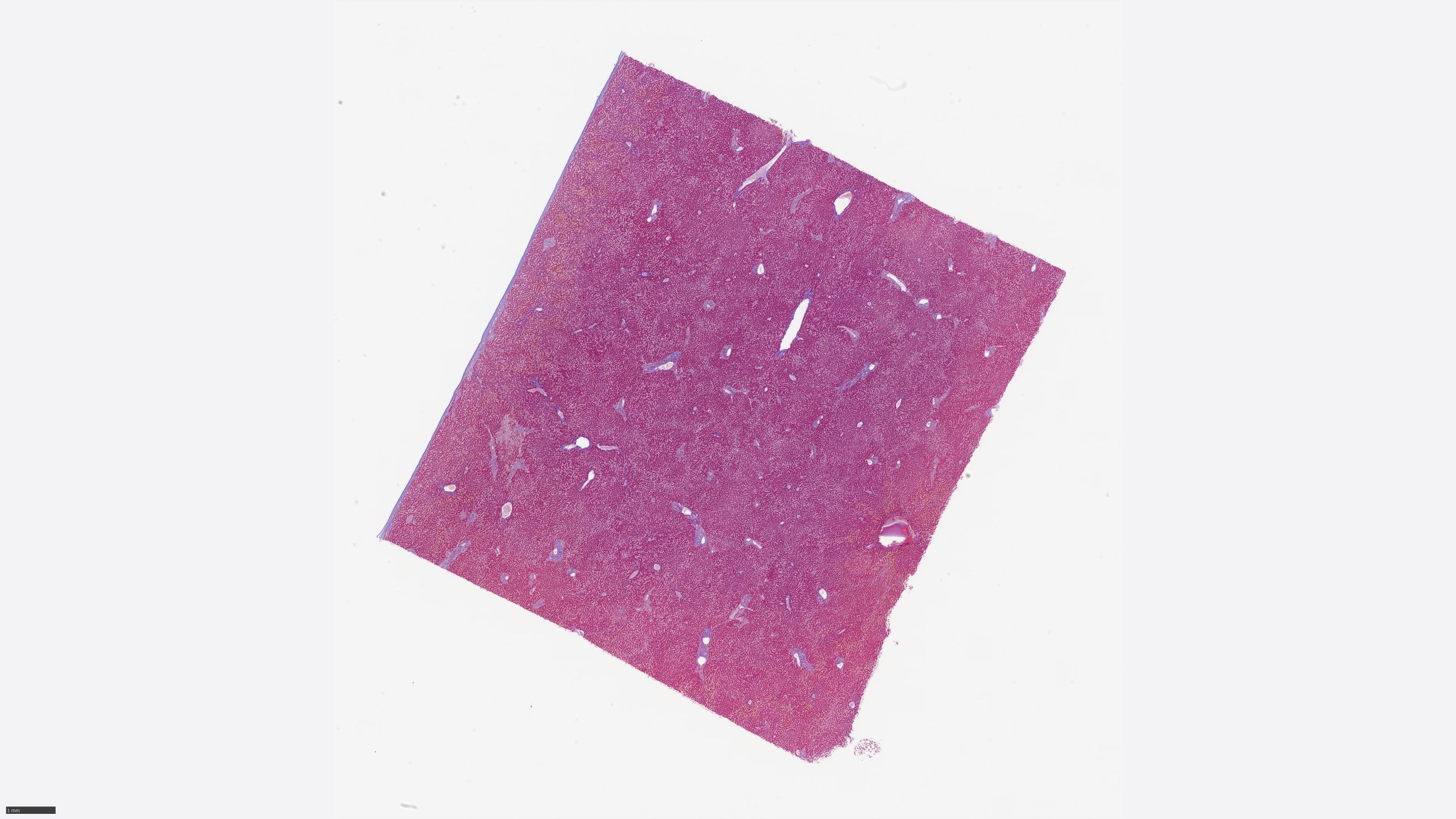 Liver_Azan