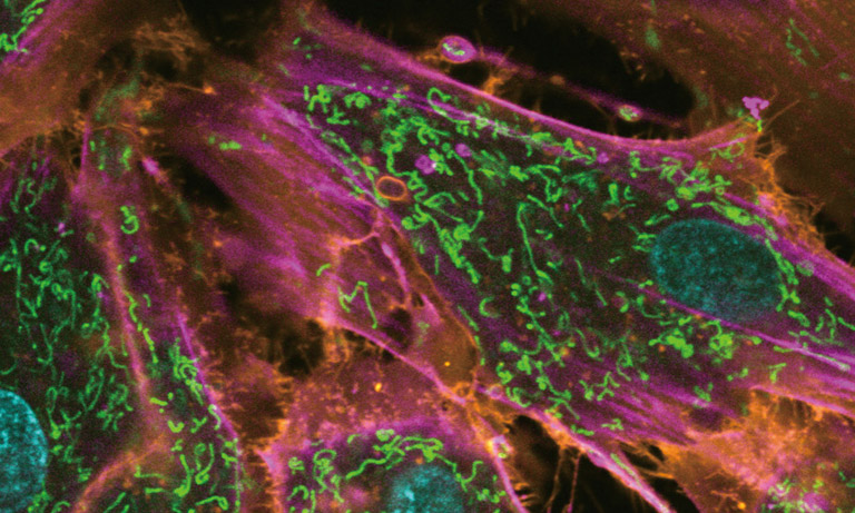 MEMS confocal unit Technology