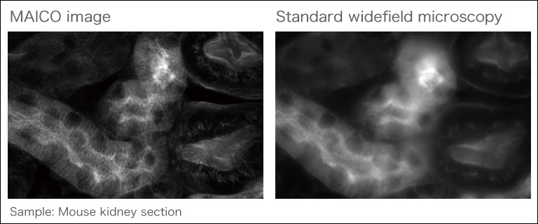 the principle of confocal microscopy | MEMS confocal unit | Hamamatsu ...