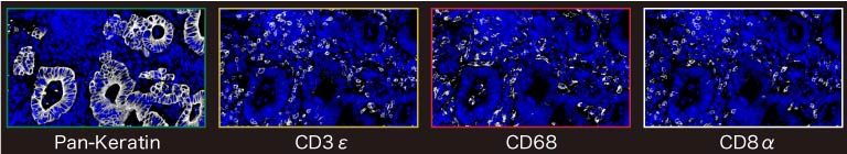 Overlay image of DAPI (blue) and individual targets (white)