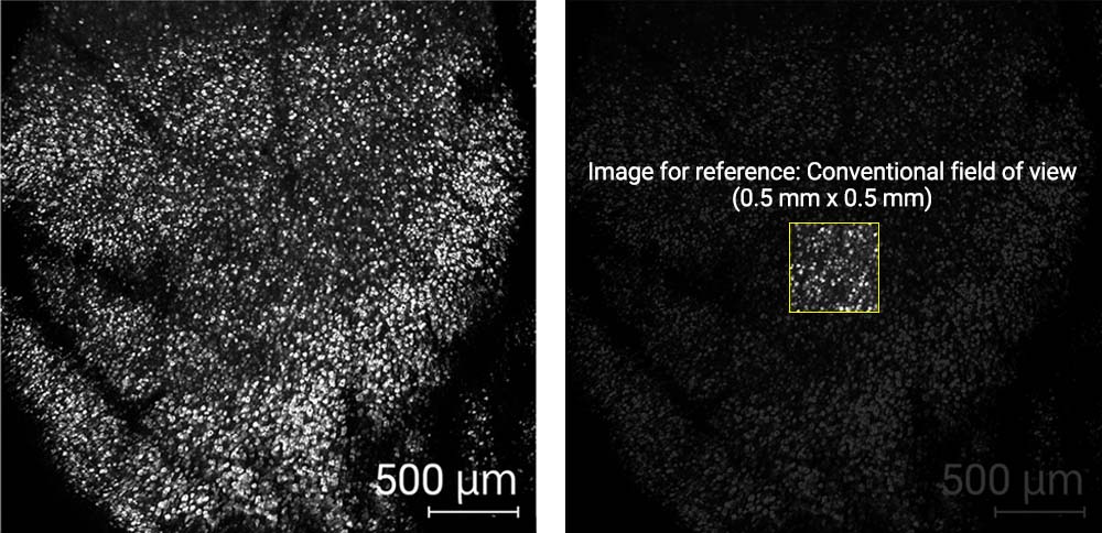 Laser scanning microscopy