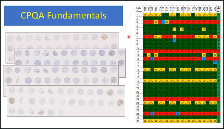 Webinar - CPQA  fundamentals